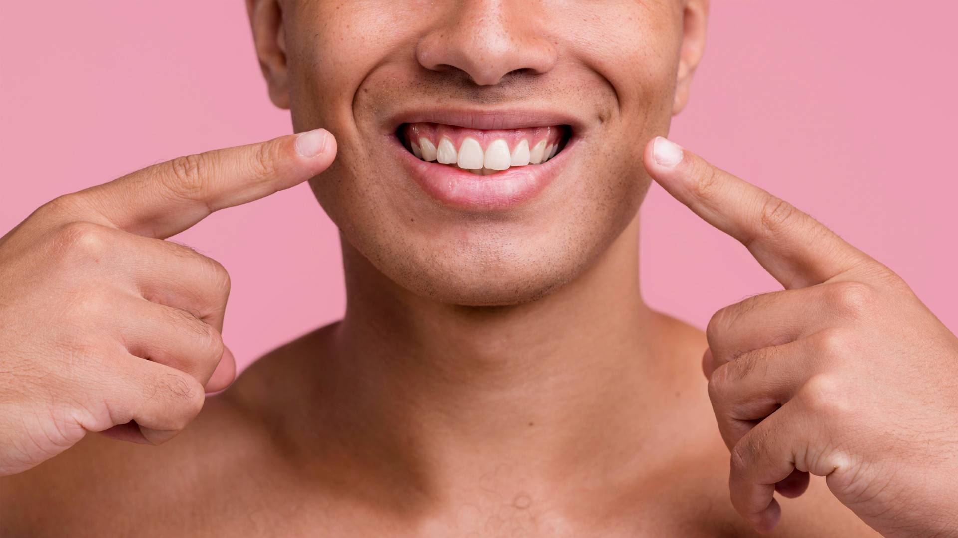 Gummy Smile Tedavisi